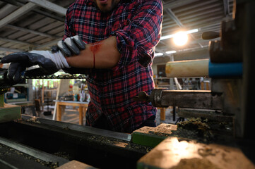 Accident in work of carpenter mistake or remiss, an arm of carpenter injury from concussion in a...