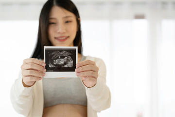 Close up hand ultrasound to help check the pregnancy for mother that the child is developing in the womb that is growing. And saw the image of the child moving in the womb  