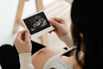 Close up hand ultrasound to help check the pregnancy for mother that the child is developing in the womb that is growing. And saw the image of the child moving in the womb  