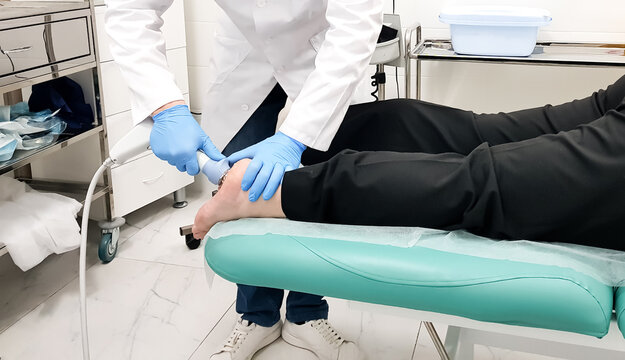 Extracorporeal shock wave therapy ESWT of heel. Visit to office of orthopedic surgeon doctor. Effective non-surgical treatment, pain relief. Physical therapy for plantarf ascitis with shock waves