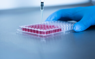 Cell culture at the cell culture genetic bioprocess medicine and medical labrotory