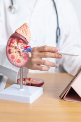 Doctor with Kidney Adrenal gland anatomy model and tablet. disease of Urinary system and Stones,...