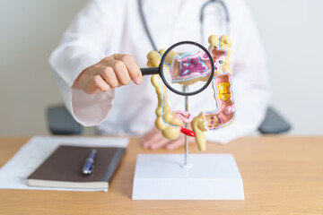 Doctor with human Colon anatomy model and magnifying glass. Colonic disease, Large Intestine, Colorectal cancer, Ulcerative colitis, Diverticulitis, Irritable bowel syndrome and Digestive system
