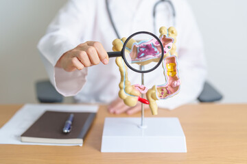 Doctor with human Colon anatomy model and magnifying glass. Colonic disease, Large Intestine,...
