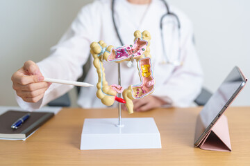 Doctor with human Colon anatomy model and tablet. Colonic disease, Large Intestine, Colorectal cancer, Ulcerative colitis, Diverticulitis, Irritable bowel syndrome and Digestive system