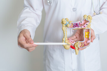 Doctor holding human Colon anatomy model. Colonic disease, Large Intestine, Colorectal cancer,...