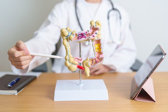 Doctor with human Colon anatomy model and tablet. Colonic disease, Large Intestine, Colorectal cancer, Ulcerative colitis, Diverticulitis, Irritable bowel syndrome and Digestive system