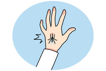 Close up of mosquito bite hand. Bug or insect biting person leave spot or mark. Healthcare and nature. Vector illustration.