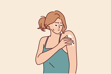 Woman with sunburned applies healing cream on shoulder to repair skin after exposure to ultraviolet. Sad girl who has sunburned face and hands suffers from itching or flaky skin causing pain