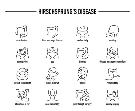 Hirschsprung's Disease symptoms, diagnostic and treatment vector icon set. Line editable medical icons.