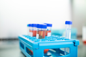 Cell culture experiments