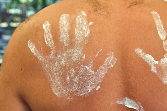 Bare man back hand marked sunscreen