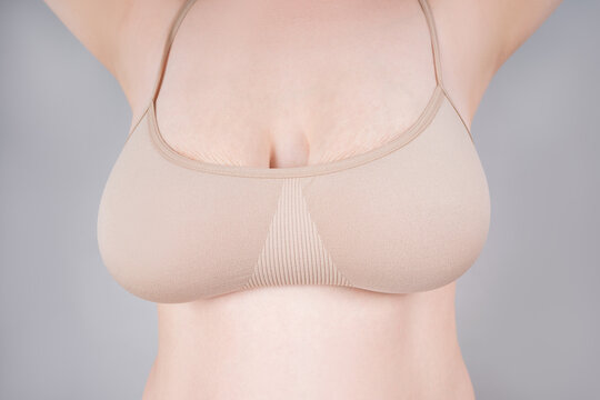Very large saggy breasts with stretch marks in beige top bra on gray background