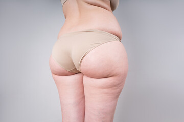 Overweight thigh, woman with fat hips and buttocks, obesity female body with cellulite on gray background - obrazy, fototapety, plakaty