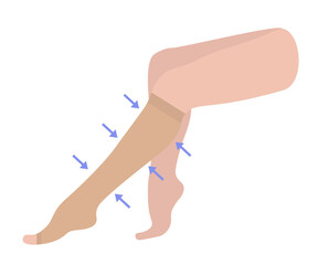 Women's Knee-high compression stockings with open toe. Medical underwear for female legs and feet. Specialized hosiery for varicose veins with pain and swelling. Vector illustration for medicine.