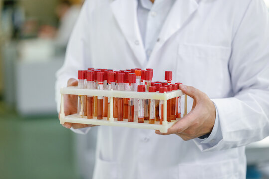 Anonymous biologist test container holder expertise sample