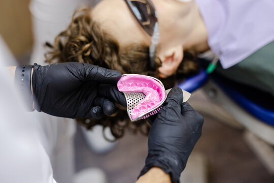 Teeth occlusion cast model anonymous dentist patient odontology 