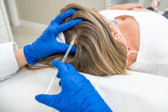 doctor performing hair mesotherapy treatment on woman