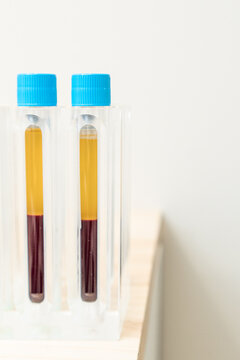 plasma specimens extracted from the machine