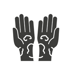 Allergy symptoms glyph icon on white background. Vector illustration.