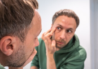 Fototapeta premium Young middle-aged man uses nourishing and regenerating cream for problem areas on his face. Skincare, wellbeing and healthy lifestyle concept.