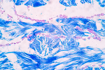 Tissue of Vein, Artery and Aorta Human under the microscope in Lab.