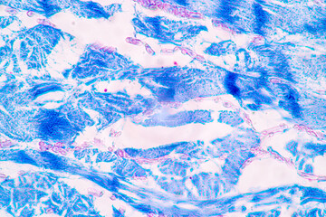 Tissue of Vein, Artery and Aorta Human under the microscope in Lab.