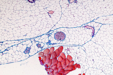 Tissue of Vein, Artery and Aorta Human under the microscope in Lab.