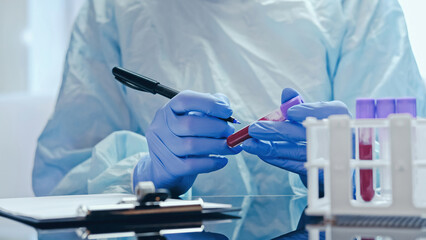 Laboratory diagnostics. Test results. Technician hands in medical protective gloves marking blood...