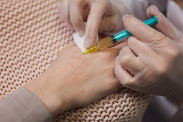 Doctor doing stem cell therapy on a patient's elbow after the injury. Treating knee pain with...