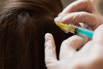 Plasma treatment, plasmolifting or PRP method point the introduction of the patient's own plasma...