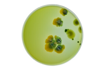 Colonies of different bacteria and mold fungi grown on Petri dish with nutrient agar, Test various germs, virus, Coronavirus, Corona, COVID-19, Microbial population count. Food science.