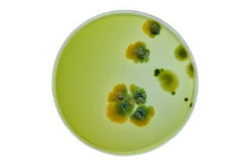 Colonies of different bacteria and mold fungi grown on Petri dish with nutrient agar, Test various germs, virus, Coronavirus, Corona, COVID-19, Microbial population count. Food science.