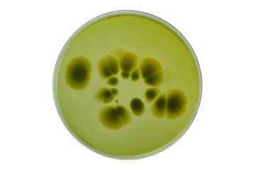 Colonies of different bacteria and mold fungi grown on Petri dish with nutrient agar, Test various...