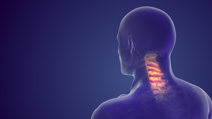 Obraz premium Neck pain or cervical postural syndrome