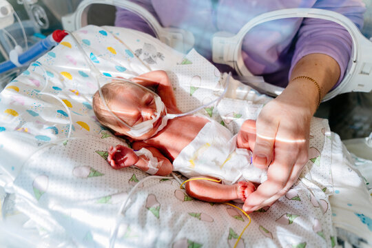 Unrecognizable mother touch and care premature baby placed in a medical incubator. Neonatal intensive care unit in hospital.