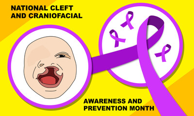 illustration of a cleft baby inside a white circle purple border and purple awareness ribbon and bold text. commemorating the NATIONAL CLEFT AND CRANIOFACIAL AWARENESS AND PREVENTION MONTH
