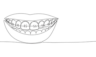 Continuous line drawing of braces for teeth. Vector illustration as line art outline wallpaper for minimal poster, template, banner