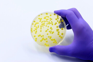 A Petri dish with a culture of bacteria from different species