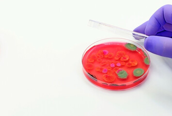 Hand of a researcher showing a close-up of a microbiological culture plate with mold and bacteria