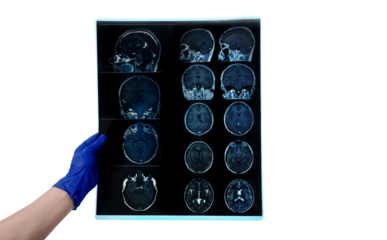 hand in glove holds MRI brain scan or magnetic resonance image results, neurology concept, snapshot isolated on transparent background