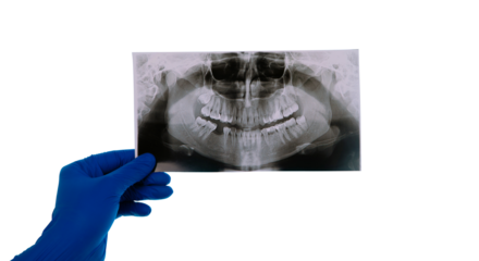 dentist holding snapshot the patient's tooth isolated on transparent background, the doctor analyzes the jaw image
