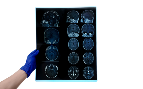 hand in glove holds MRI brain scan or magnetic resonance image results, neurology concept, snapshot isolated on transparent background