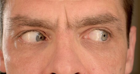 Fototapeta premium Eye training, a man makes a movement to the left, to the right to increase the tone of the organ of vision. Load on the internal organs, shifting the focus of attention.