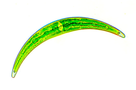 Closterium