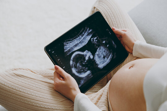 Cropped young pregnant woman wears white pyjamas hold in hand picture of ultrasound examination rest relax spend time in bedroom lounge home in own room Maternity family pregnancy expectation concept