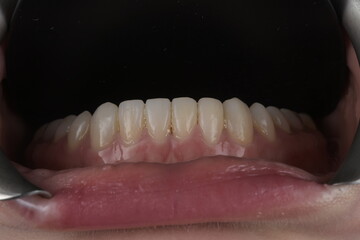 Obraz premium Enchanting Dental Masterpieces: Unveiling Captivating Images of Dental Perfection