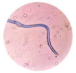 Unknown parasite like worm under microscopy with plenty bacteria and calcium oxalate