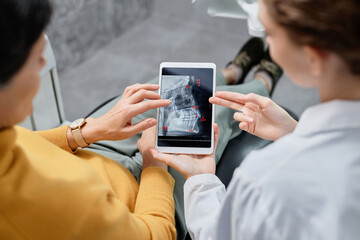 Top view closeup of dentist holding tablet with X ray images while consulting patient on dental...