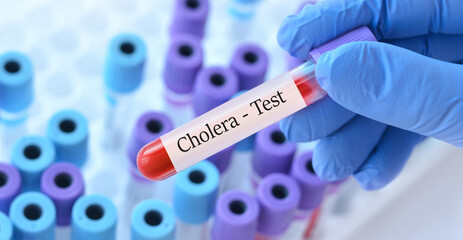 Naklejka premium Doctor holding a test blood sample tube with Cholera test on the background of medical test tubes with analyzes.